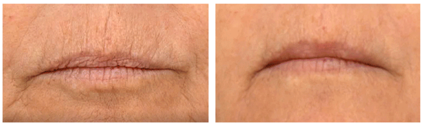 Advanced Line Lift Serum | 45 Anwendungen