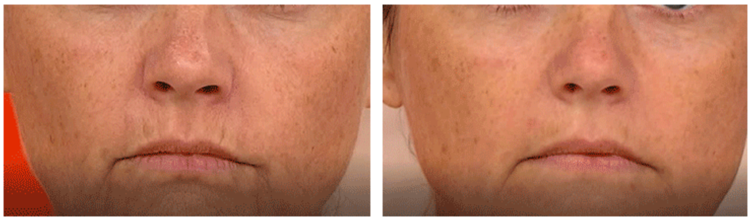 Advanced Line Lift Serum | 45 Anwendungen